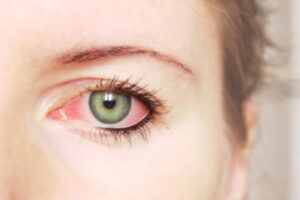 What is Hay Fever Washington DC?